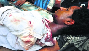 Injured CPI-M activist Feroz Mollah at Bhangor. 